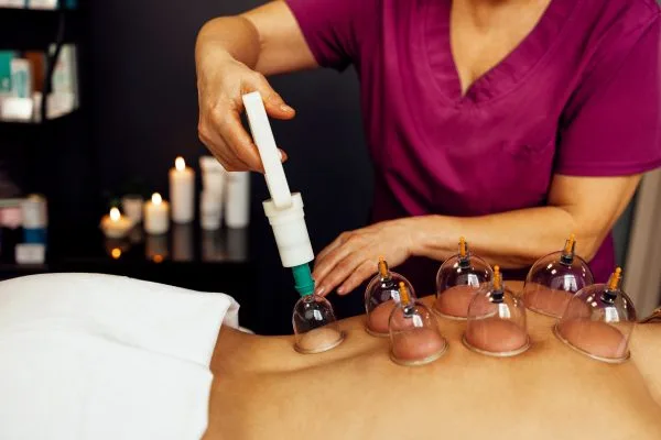 Therapist applying cupping therapy to a guest's back